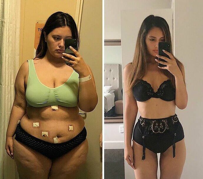 Nena antes e despois da perda de peso con cápsulas KETO Complete